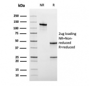 SDS-PAGE analysis of purified, BSA-free recombinant CD45RA antibody (clone rPTPRC/1131) as confirmation of integrity and purity.
