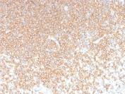 IHC staining of FFPE human spleen with recombinant CD45RA antibody (clone rPTPRC/1131). HIER: boil tissue sections in pH 9 10mM Tris with 1mM EDTA for 20 min and allow to cool before testing.