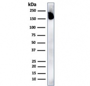 Western blot testing of human spleen lysate with recombinant CD45RA antibody. Expected molecular weight: 147-220 kDa depending on glycosylation level.