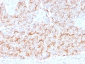 IHC staining of FFPE human lung with Alpha Tubulin antibody (clone TUBA/3038). HIER: boil tissue sections in pH 9 10mM Tris with 1mM EDTA for 20 min and allow to cool before testing.