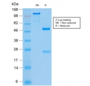 SDS-PAGE analysis of purified, BSA-free recombinant Cytokeratin 8/18 antibody (clone KRT8.18/2297R) as confirmation of integrity and purity.