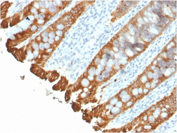 IHC staining of FFPE human colon with recombinant Cytokeratin 8/18 antibody (clone KRT8.18/2297R). HIER: boil tissue sections in pH 9 10mM Tris with 1mM EDTA for 20 min and allow to cool before testing.~
