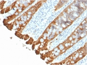 IHC staining of FFPE human colon with recombinant Cytokeratin 8/18 antibody (clone KRT8.18/2297R). HIER: boil tissue sections in pH 9 10mM Tris with 1mM EDTA for 20 min and allow to cool before testing.