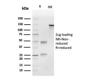 SDS-PAGE analysis of purified, BSA-free UBE2C antibody as confirmation of integrity and purity.
