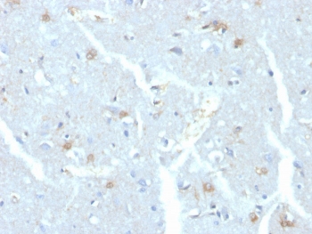 IHC staining of FFPE human brain with UBE2C antibody. HIER: boil tissue sections in pH 9 10mM Tris with 1mM EDTA for 20 min and allow to cool before testing.~