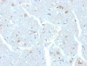 IHC staining of FFPE human brain with UBE2C antibody. HIER: boil tissue sections in pH 9 10mM Tris with 1mM EDTA for 20 min and allow to cool before testing.