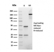 SDS-PAGE analysis of purified, BSA-free recombinant ATRX antibody as confirmation of integrity and purity.