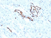 IHC staining of FFPE human ovary with CD31 antibody (clone PECAM1/3525). HIER: boil tissue sections in pH 9 10mM Tris with 1mM EDTA for 20 min and allow to cool before testing.