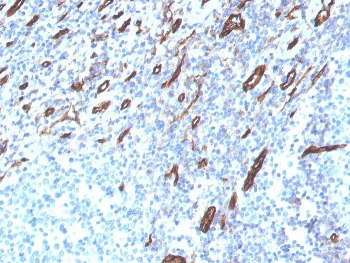 IHC staining of FFPE human tonsil with CD31 antibody (clone PECAM1/3525). HIER: boil tissue sections in pH 9 10mM Tris with 1mM EDTA for 20 min and allow to cool before testing.