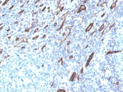 IHC staining of FFPE human tonsil with CD31 antibody (clone PECAM1/3525). HIER: boil tissue sections in pH 9 10mM Tris with 1mM EDTA for 20 min and allow to cool before testing.