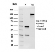 SDS-PAGE analysis of purified, BSA-free Aciculin antibody (clone 14F8/F8) as confirmation of integrity and purity.