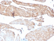IHC staining of FFPE human bladder with Aciculin antibody (clone 14F8/F8). HIER: boil tissue sections in pH 9 10mM Tris with 1mM EDTA for 20 min and allow to cool before testing.