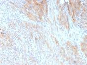 IHC staining of FFPE human uterus with Aciculin antibody (clone 14F8/F8). HIER: boil tissue sections in pH 9 10mM Tris with 1mM EDTA for 20 min and allow to cool before testing.