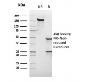 SDS-PAGE analysis of purified, BSA-free recombinant c-Myc antibody as confirmation of integrity and purity.