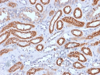 IHC staining of FFPE human spleen with recombinant CD61 antibody (clone rITGB3/1713). HIER: boil tissue sections in pH 9 10mM Tris with 1mM EDTA for 20 min and allow to cool before testing.~