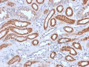 IHC staining of FFPE human spleen with recombinant CD61 antibody (clone rITGB3/1713). HIER: boil tissue sections in pH 9 10mM Tris with 1mM EDTA for 20 min and allow to cool before testing.