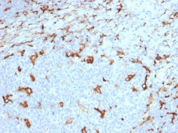 IHC staining of FFPE human tonsil with CD163 antibody (clone M130/2163). HIER: boil tissue sections in pH 9 10mM Tris with 1mM EDTA for 20 min and allow to cool before testing.