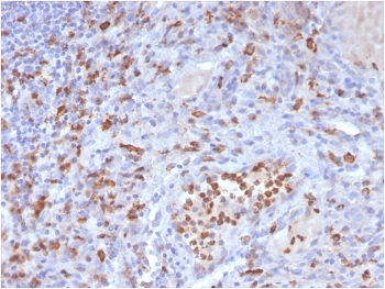 IHC staining of FFPE human tonsil with CD63 antibody (clone LAMP3/3315). HIER: boil tissue sections in pH 9 10mM Tris with 1mM EDTA for 20 min and allow to cool before testing.