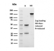 SDS-PAGE analysis of purified, BSA-free ITGB1 antibody as confirmation of integrity and purity.