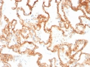 IHC staining of FFPE human lung with ITGB1 antibody. HIER: boil tissue sections in pH 9 10mM Tris with 1mM EDTA for 20 min and allow to cool before testing.
