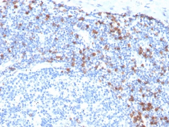 IHC staining of FFPE human tonsil with recombinant Integrin alpha E antibody (clone ITGAE/3904R). HIER: boil tissue sections in pH 9 10mM Tris with 1mM EDTA for 20 min and allow to cool before testing.~