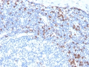 IHC staining of FFPE human tonsil with recombinant Integrin alpha E antibody (clone ITGAE/3904R). HIER: boil tissue sections in pH 9 10mM Tris with 1mM EDTA for 20 min and allow to cool before testing.