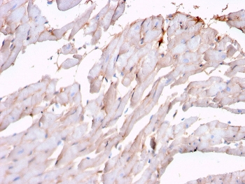 IHC staining of FFPE human heart with recombinant N-Cadherin antibody (clone rCDH2/1426). HIER: boil tissue sections in pH 9 10mM Tris with 1mM EDTA for 20 min and allow to cool before testing.~
