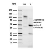 SDS-PAGE analysis of purified, BSA-free recombinant CDH2 antibody as confirmation of integrity and purity.
