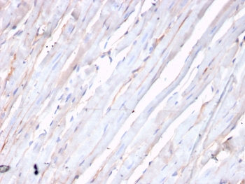 IHC staining of FFPE human heart with recombinant CDH2 antibody. HIER: boil tissue sections in pH 9 10mM Tris with 1mM EDTA for 20 min and allow to cool before testing.~