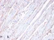 IHC staining of FFPE human heart with recombinant CDH2 antibody (clone CDH2/3874R). HIER: boil tissue sections in pH 9 10mM Tris with 1mM EDTA for 20 min and allow to cool before testing.