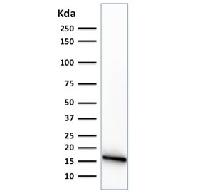 Western blot testing of human PANC-1 cell lysate with CELA3B antibody (clone CELA3B/1374).~