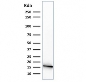 Western blot testing of human PANC-1 cell lysate with CELA3B antibody (clone CELA3B/1374).
