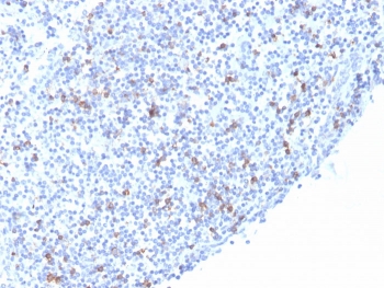 IHC staining of FFPE human tonsil with recombinant ITGAE antibody (clone rITGAE/2063). HIER: boil tissue sections in pH 9 10mM Tris with 1mM EDTA for 20 min and allow to cool before testing.~
