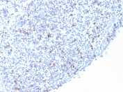 IHC staining of FFPE human tonsil with recombinant ITGAE antibody (clone rITGAE/2063). HIER: boil tissue sections in pH 9 10mM Tris with 1mM EDTA for 20 min and allow to cool before testing.