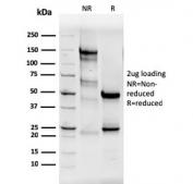 SDS-PAGE analysis of purified, BSA-free Estrogen Receptor alpha antibody (clone ESR1/3565) as confirmation of integrity and purity.