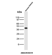 Recombinant AMACR Antibody Human Kidney WB. Western blot analysis of human kidney tissue lysate using recombinant AMACR Antibody clone AMACR/3931R demonstrates a distinct band at approximately 40-42 kDa, consistent with the predicted molecular weight of Alpha-methylacyl-CoA racemase / AMACR. The observed signal supports expression of this peroxisomal and mitochondrial metabolic enzyme involved in branched-chain fatty acid and bile acid metabolism within renal tissue.