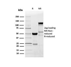 SDS-PAGE analysis of purified, BSA-free recombinant Myelin Basic Protein antibody (clone MBP/4277R) as confirmation of integrity and purity.