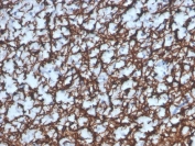 IHC staining of FFPE human brain with recombinant Myelin Basic Protein antibody (clone MBP/4277R). HIER: boil tissue sections in pH 9 10mM Tris with 1mM EDTA for 20 min and allow to cool before testing.