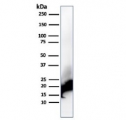 Western blot testing of human brain lysate with recombinant MBP antibody (clone rMBP/4288). Isoforms may be visualized from 20~37 kDa.