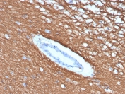 IHC staining of FFPE human cerebellum with recombinant MBP antibody (clone rMBP/4288). HIER: boil tissue sections in pH 9 10mM Tris with 1mM EDTA for 20 min and allow to cool before testing.