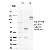 SDS-PAGE analysis of purified, BSA-free recombinant MBP antibody (clone rMBP/4288) as confirmation of integrity and purity.