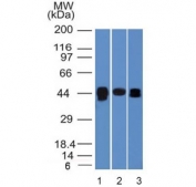 Western blot testing of human A) HepG2, B) PC-3 and C) HeLa cell lysate wiht TIA-1 antibody (clone TIA1/1313). The long and short forms differ by 17 amino acids. Predicted molecular weight: ~43 kDa and ~15 kDa (granulocyte-associated isoform).