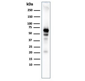 Western blot testing of human MCF7 cell lysate with recombinant AKT1 antibody. Predicted molecular weight ~56 kDa.~