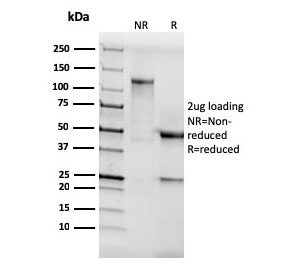 SDS-PAGE analysis of purified, BSA-free recombinant AKT1 antibody (clone AKT1/3898R) as confirmation of integrity and pur