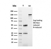 SDS-PAGE analysis of purified, BSA-free Dystrophin antibody (clone DMD/3677) as confirmation of integrity and purity.