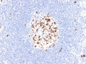 IHC staining of FFPE human lymph node with recombinant TOP2A antibody (clone TOP2A/4397R). HIER: boil tissue sections in pH 9 10mM Tris with 1mM EDTA for 20 min and allow to cool before testing.