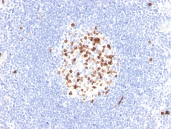 IHC staining of FFPE human lymph node with recombinant TOP2A anti