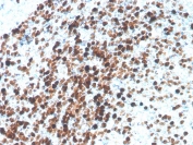 IHC staining of FFPE human tonsil with recombinant TOP2A antibody (clone TOP2A/4397R). HIER: boil tissue sections in pH 9 10mM Tris with 1mM EDTA for 20 min and allow to cool before testing.