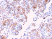 IHC staining of FFPE human kidney with SERBP1 antibody. HIER: boil tissue sections in pH 9 10mM Tris with 1mM EDTA for 20 min and allow to cool before testing.