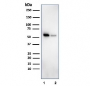 Western blot testing of human 1) K562 and 2) PC-3 cell lysate with SERBP1 antibody. Predicted molecular weight ~45 kDa but observed at 45-60 kDa.